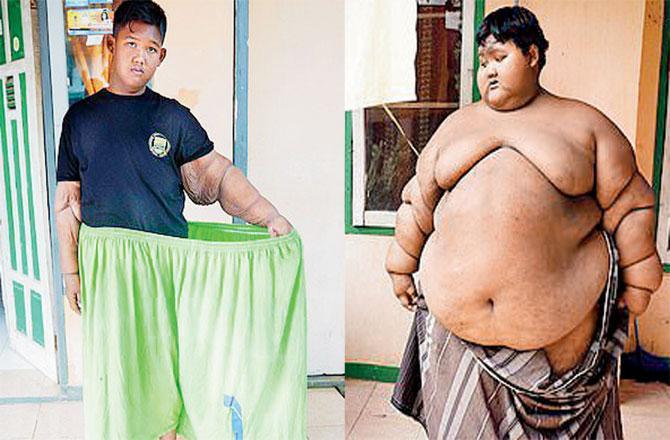 3 વર્ષમાં ઉતાર્યુ 82 કિલો વજન 