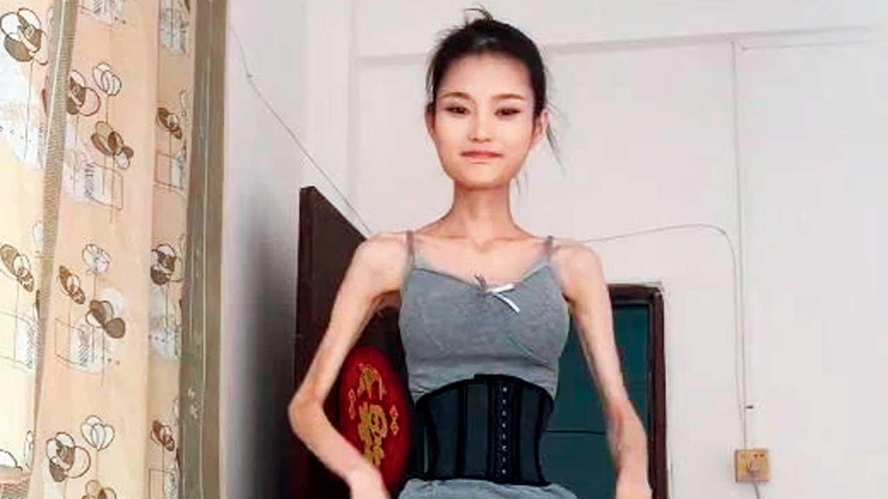 બેબી ટિન્ઝી