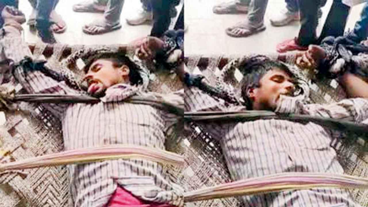 કૂતરો કરડ્યા પછી ૧૮ કલાકમાં જ હડકવા થયો યુવાનને