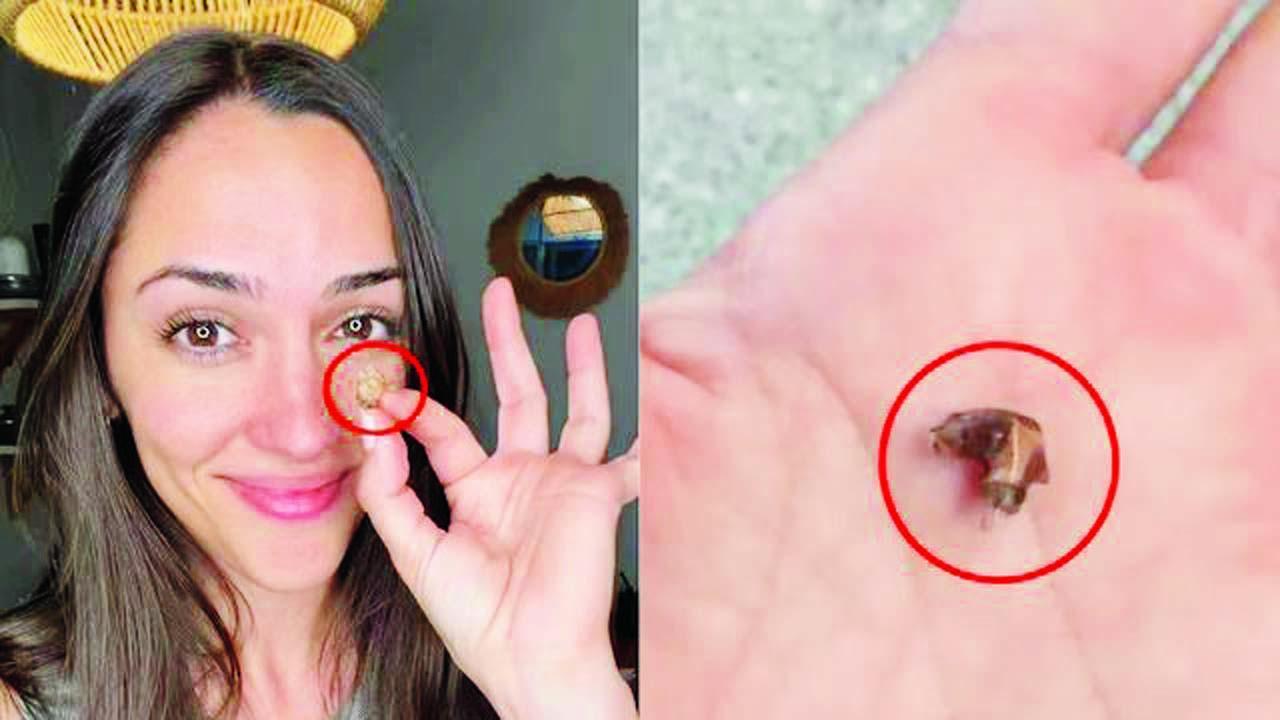 કન્દેલા રેબાઉન્ડ