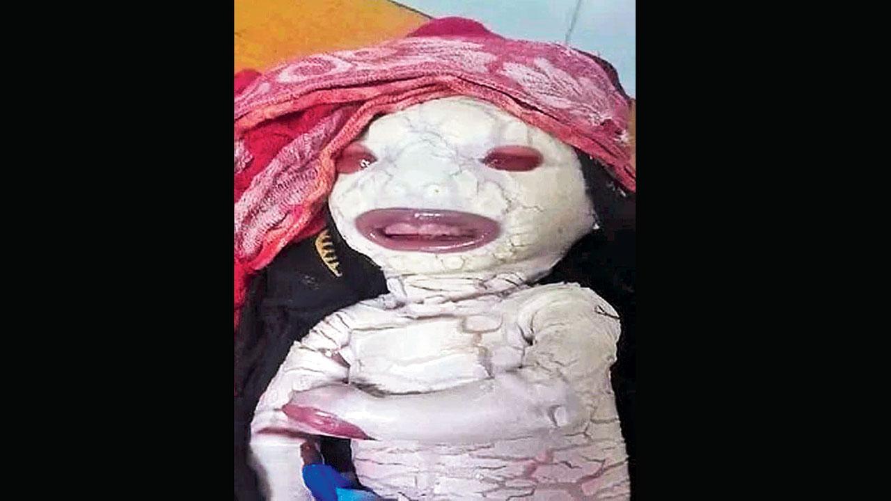 મધ્ય પ્રદેશમાં એલિયન બેબી જેવા આ બાળકે ચકચાર જગાવી દીધી