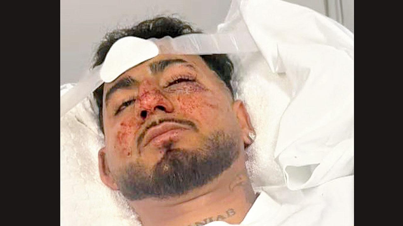 ૨૩ વર્ષના ભારતીય સ્ટુડન્ટ ચરણપ્રીત સિંહ પર હિંસક હુમલો કરવામાં આવ્યો