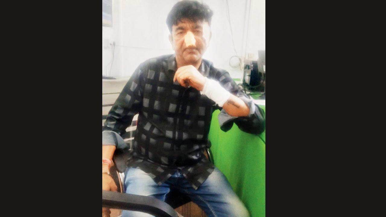 મુકેશ છેડાને મોઢા અને હાથ પર ઈજા થઈ હતી.