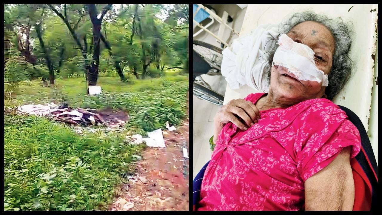 આરે કૉલોનીમાં આ કચરામાં મહિલા મળી આવી હતી. ત્યાર બાદ તેને કૂપર હૉસ્પિટલમાં ઍડ‍્મિટ કરવામાં આવી હતી.