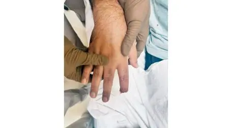 સેક્રેટરી વિશાલ દેવરેની આંગણી કાપી.