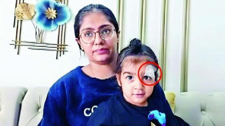 મેરઠમાં રહેતા જસપિંદર સિંહના બે વર્ષના દીકરા મનરાજને ઘરમાં રમતાં-રમતાં આંખ પાસે ખૂબ ઊંડો ઘા થયો હતો