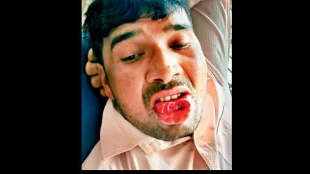 તસવીર સૌજન્યઃ સોશ્યલ મીડિયા