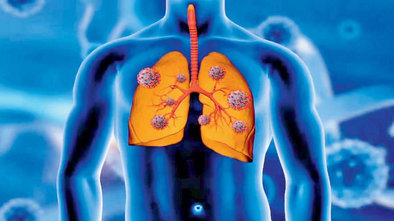 પ્રતીકાત્મક તસવીર