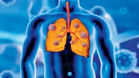 પ્રતીકાત્મક તસવીર