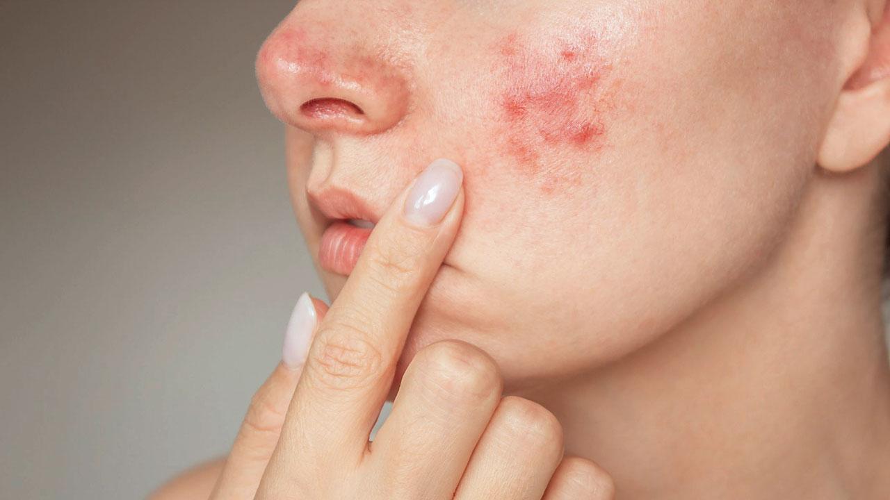 પ્રતીકાત્મક તસવીર