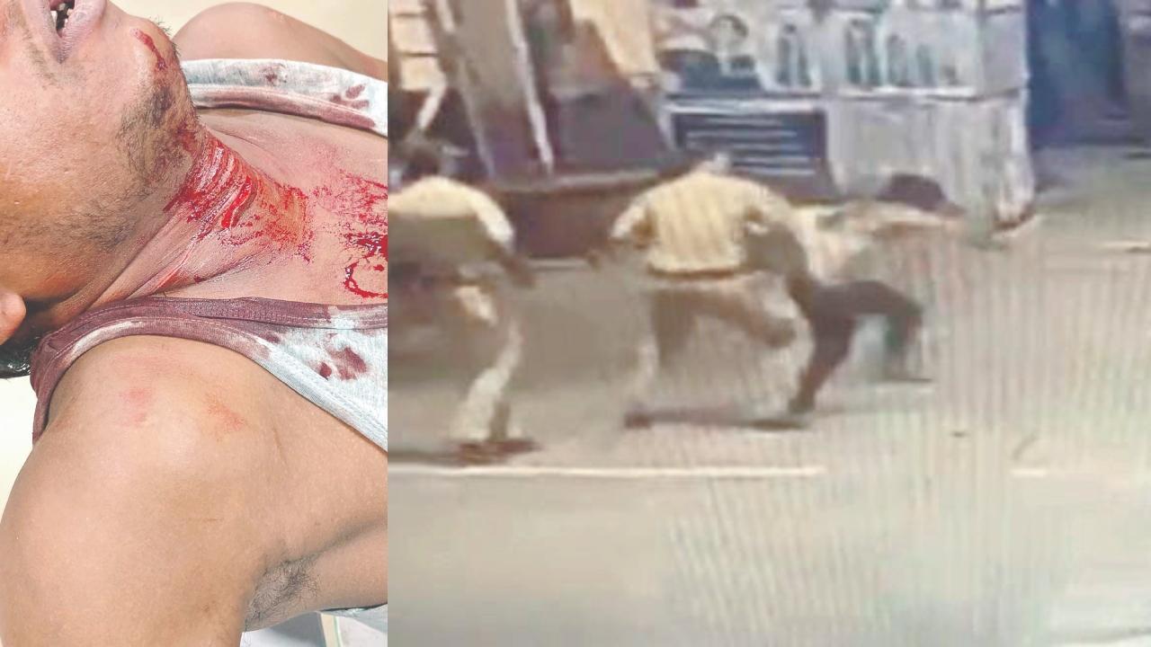 દાદર રેલવે-સ્ટેશન પર આત્મહત્યાનો પ્રયાસ કરનાર યુવાનનું ગળું કપાયું હતું, ટ્રેનની સામે કૂદવાનો પ્રયાસ કરતા યુવાનને અટકાવતા પોલીસના જવાનો.