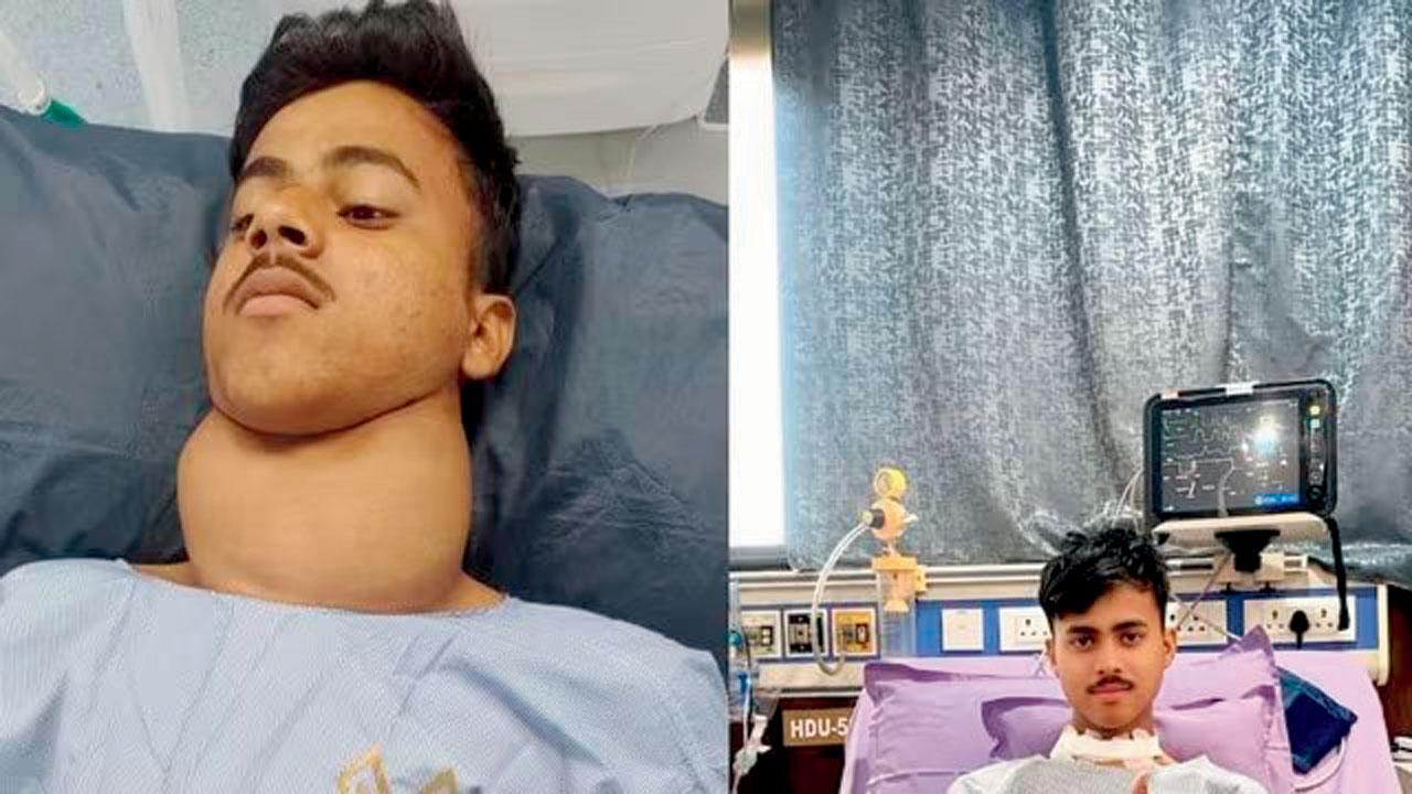 મધ્ય પ્રદેશના ૧૬ વર્ષના સાહિલ ખાન નામના ટીનેજરને જન્મથી જ થાઇરૉઇડની ગંભીર બીમારી