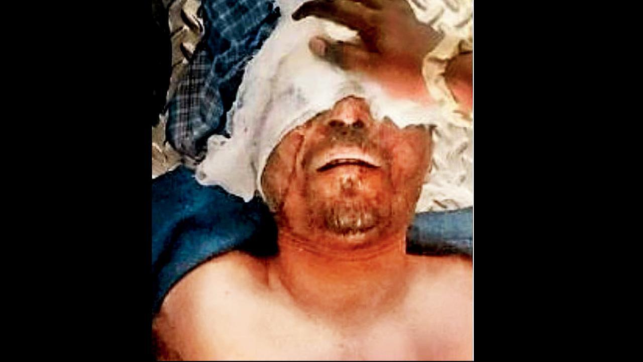 એક મુસાફરને લોખંડનો સળિયો માથા અને ચહેરાના ભાગે વાગતાં તે લોહીલુહાણ થઈ ગયો હતો