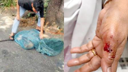 શ્વાનપથક હડકાયેલા કૂતરાને પકડીને લઈ ગયું હતું અને ઘટનામાં ઈજાગ્રસ્ત વ્યક્તિ