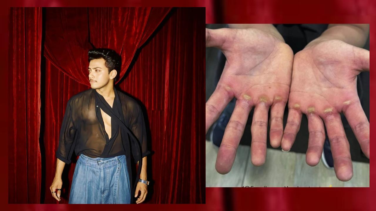 ઍક્ટર વિશાલ જેઠવા અને તેના પંજાનો ફોટો