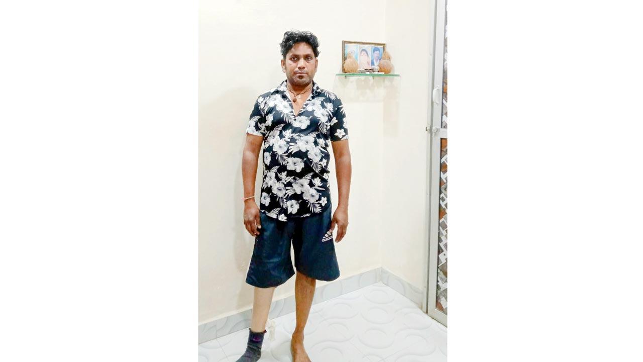અકસ્માતમાં પગ ગુમાવનાર ધીરજ સોલંકી.