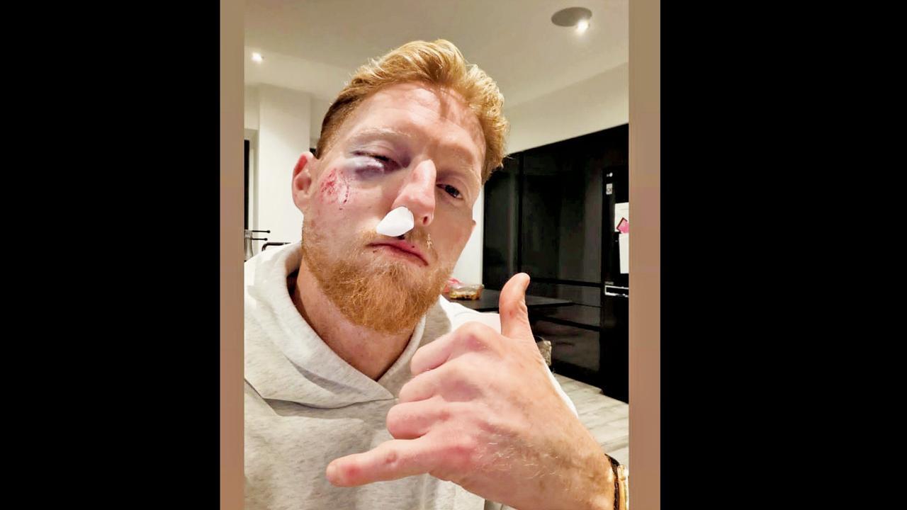 હું હવે ક્યારેય હેલ્મેટ વગર રમીશ નહીં