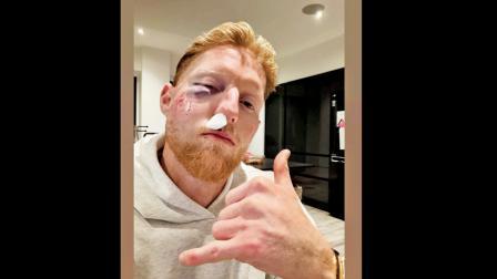 હું હવે ક્યારેય હેલ્મેટ વગર રમીશ નહીં