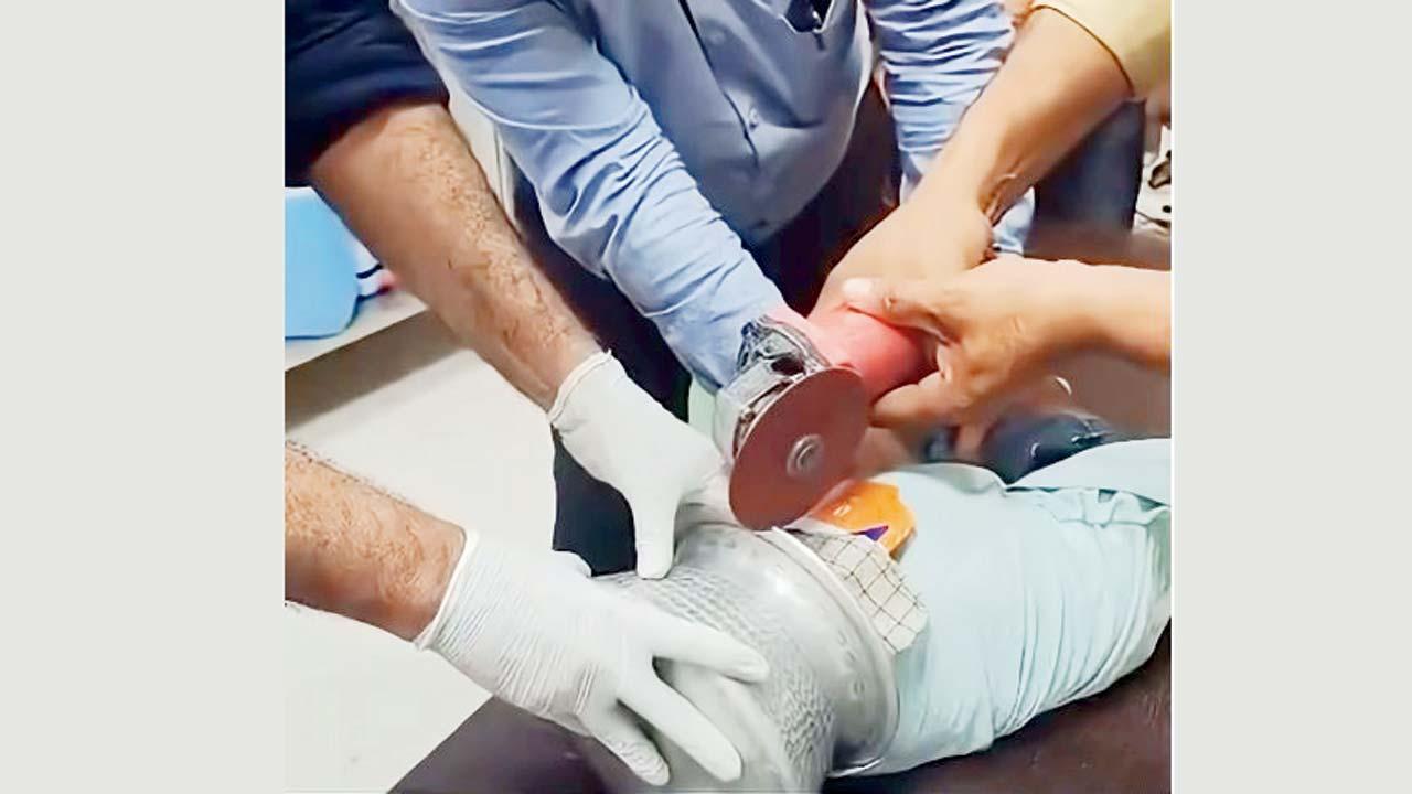 હૉસ્પિટલમાં કામ કરતા પ્લમ્બરને બોલાવવામાં આવ્યો. વાસણ કાપતી વખતે વાસણ અને બાળકના માથા વચ્ચે ભીનું કપડું અને લાકડીની ‌શીટ ભરાવી દીધી