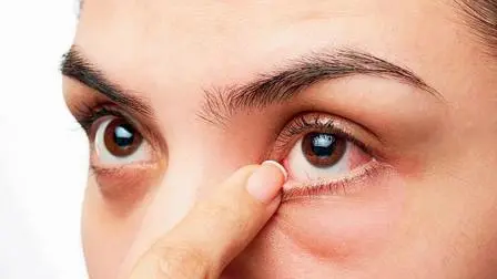 પ્રતીકાત્મક તસવીર