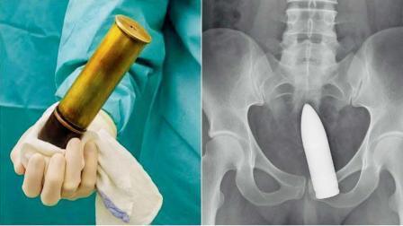 સર્જરી દરમ્યાનના અને પછીના ફોટો