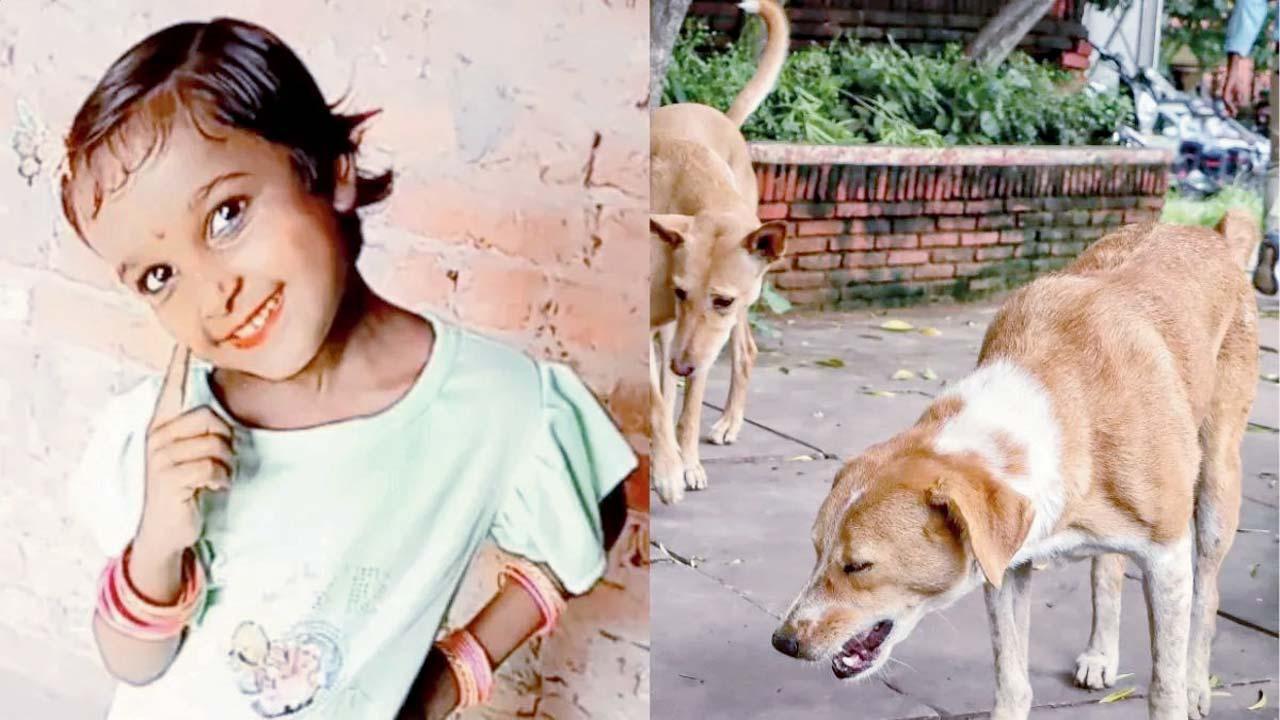રખડુ કૂતરાઓએ બચકાં ભરી-ભરીને નવ વર્ષની છોકરીનો હાથ કરડીને અલગ કરી નાખ્યો