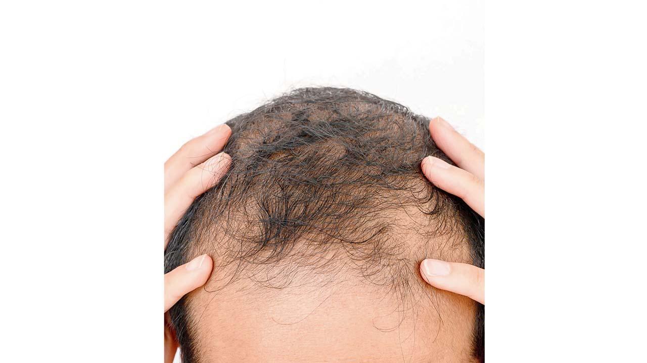 પ્રતીકાત્મક તસવીર