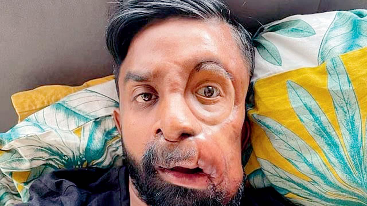 જુઓ આ ભાઈના ચહેરાને