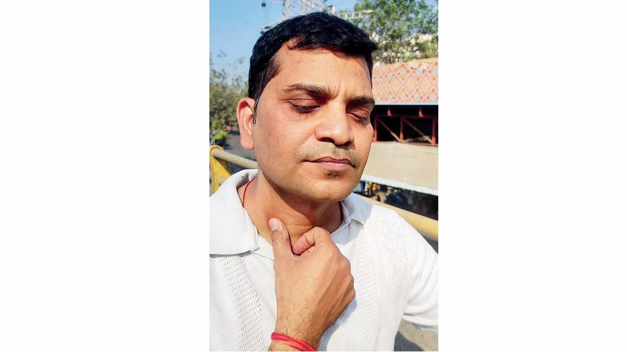 ગળામાં માંજાને લીધે પડેલા જખમનાં નિશાન બતાવી રહેલો જયશંકર પાંડે.