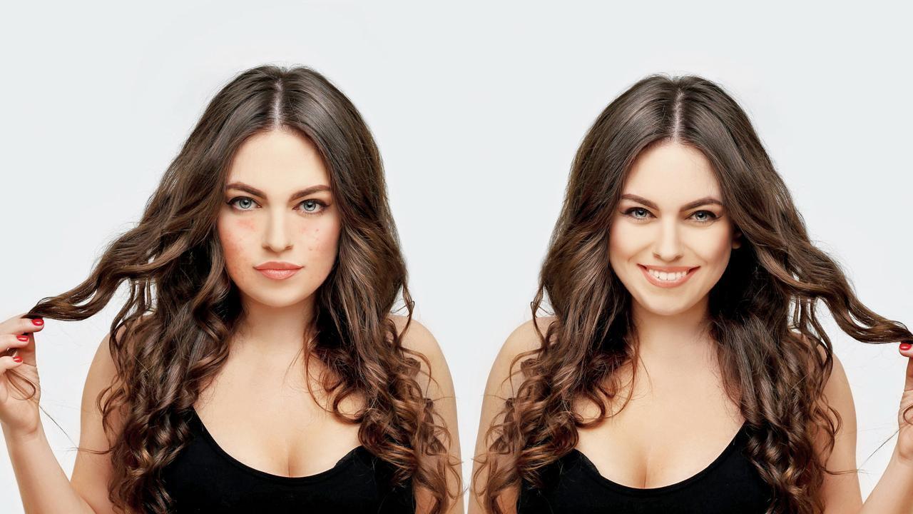 પ્રતીકાત્મક તસવીર