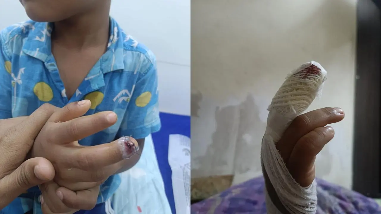 બાળકને હૉસ્પિટલમાં સારવાર આપવામાં આવી હતી 