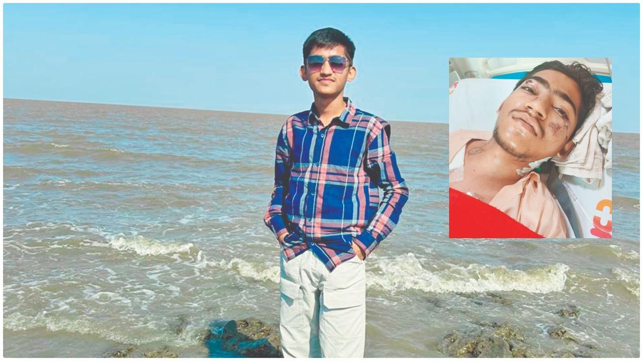 વિમાન-દુર્ઘટના સમયે મેસમાં જમવા બેઠેલો સંકેત વરિયા બચી ગયો હતો. (વિમાન-દુર્ઘટનામાં ઘાયલ થયા પછી હૉસ્પિટલમાં સારવાર લઈ રહેલા સંકેત વરિયાની તસવીર)