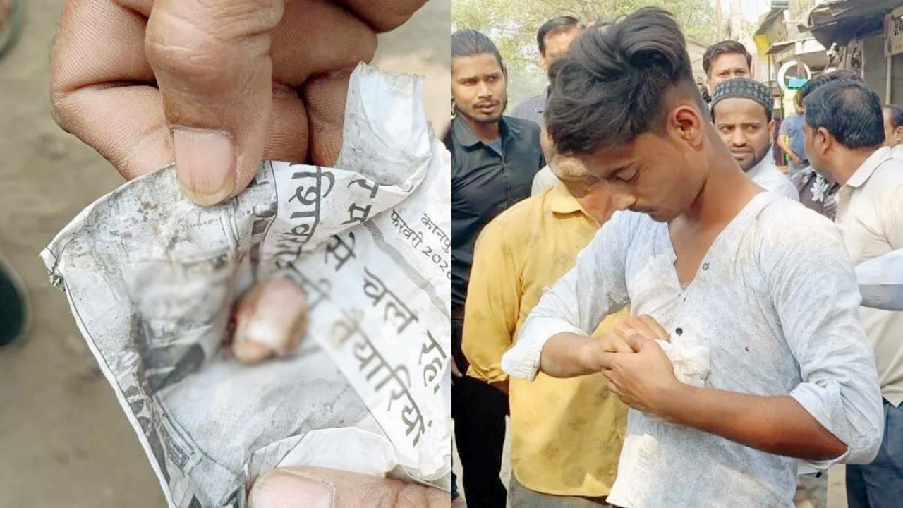 ૭ રૂપિયાની સિગારેટ માટે વિવાદ થતાં યુવકે દુકાનદારની આંગળીનું ટેરવું કરડી નાખ્યું