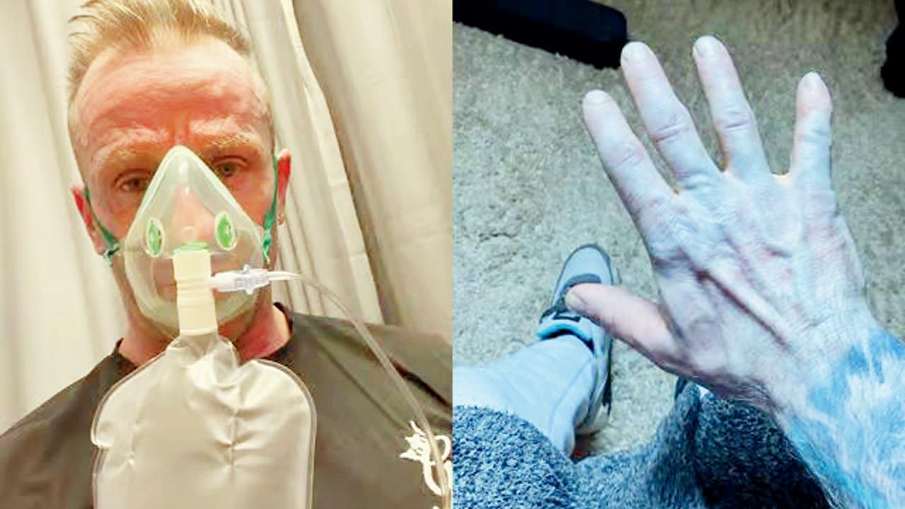 ઇન્જેક્શન લગાવવા માટે આલ્કોહૉલવાળા વાઇપથી ત્વચા સાફ કરી ત્યાં જ આવ્યો ટ્વિસ્ટ