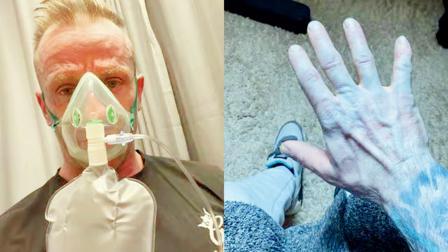 ઇન્જેક્શન લગાવવા માટે આલ્કોહૉલવાળા વાઇપથી ત્વચા સાફ કરી ત્યાં જ આવ્યો ટ્વિસ્ટ