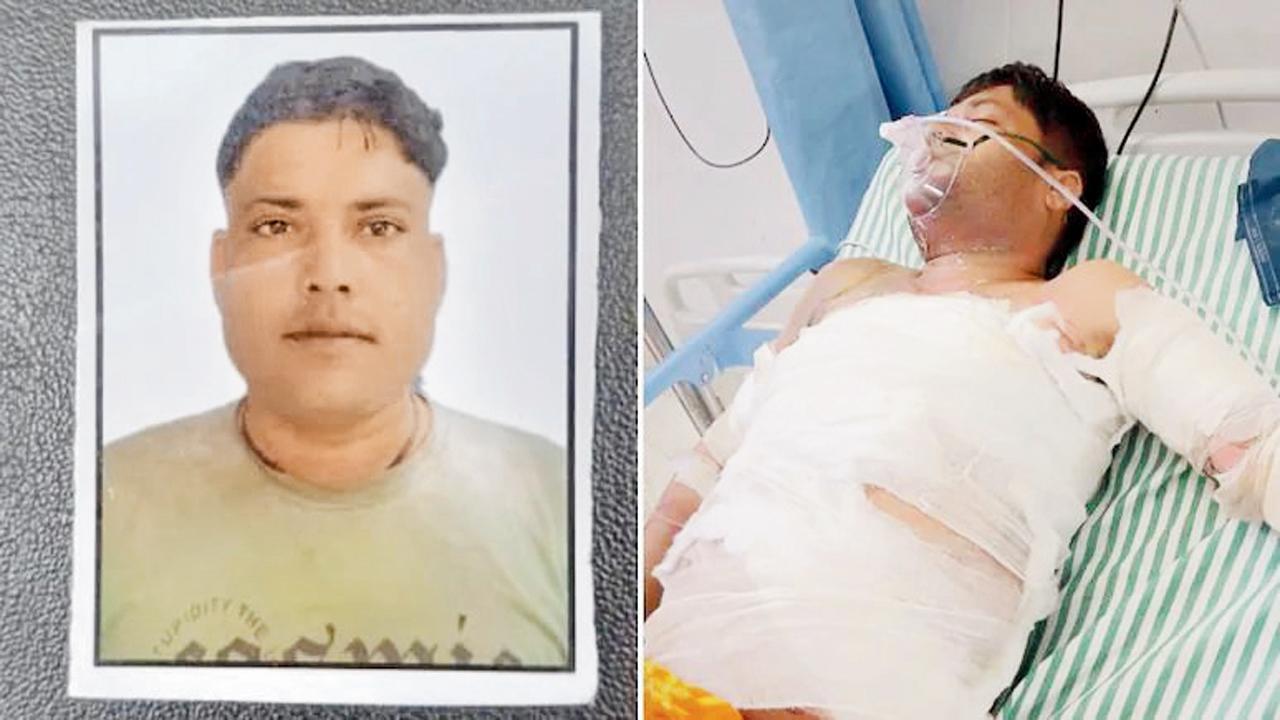 ૮૦ ટકા બળી ગયેલા ચાંદે ૭ દિવસ ‌જિંદગી અને મોત વચ્ચે ઝઝૂમીને બુધવારે રાતે છેલ્લા શ્વાસ લીધા હતા