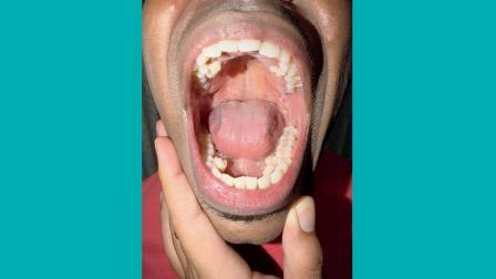 પ્રથાબનું નામ સૌથી વધુ દાંત ધરાવતી વ્યક્તિ તરીકે ગિનેસ વર્લ્ડ રેકૉર્ડ્‍સમાં નોંધાયું છે.