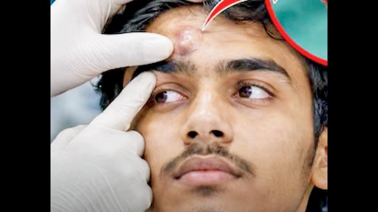 ટીનેજરને આંખની ઉપર નીકળી આવ્યો દાંત