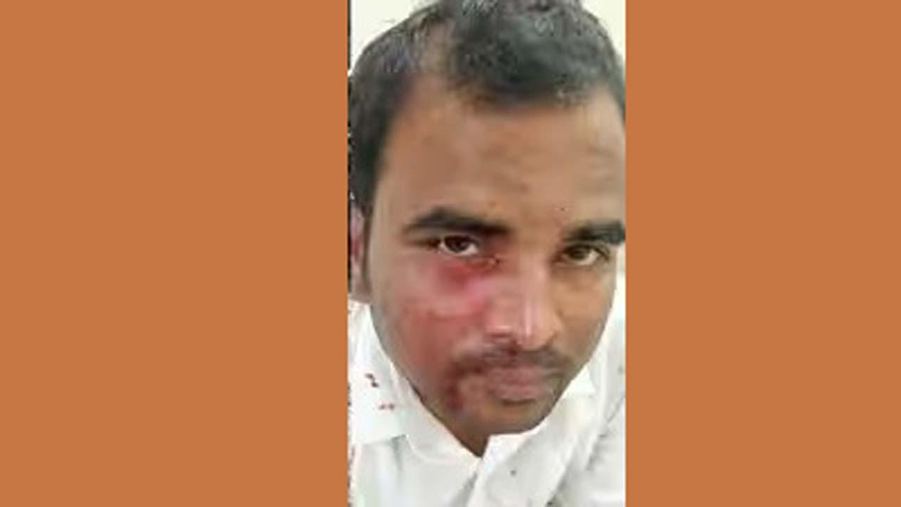 હુમલામાં જખમી થયેલો ટિકિટચેકર આશિષ ગુપ્તા.
