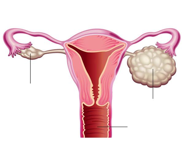 ઓવરીમાં કોઈ ગાંઠ હોય તો એને સામાન્ય સમજીને અવગણવાની ભૂલ ન કરો