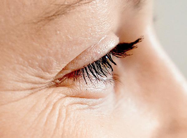 જો તમે હસવાનું ભૂલી ગયા હો અને વારંવાર ગુસ્સો કરતા હો તો તમને ક્રોઝ ફીટ રિન્કલ્સ આવી શકે છે