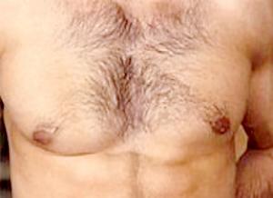  છાતી પર વાળ ધરાવતા પુરુષો ૮૦ ટકા મહિલાઓને પસંદ નથી